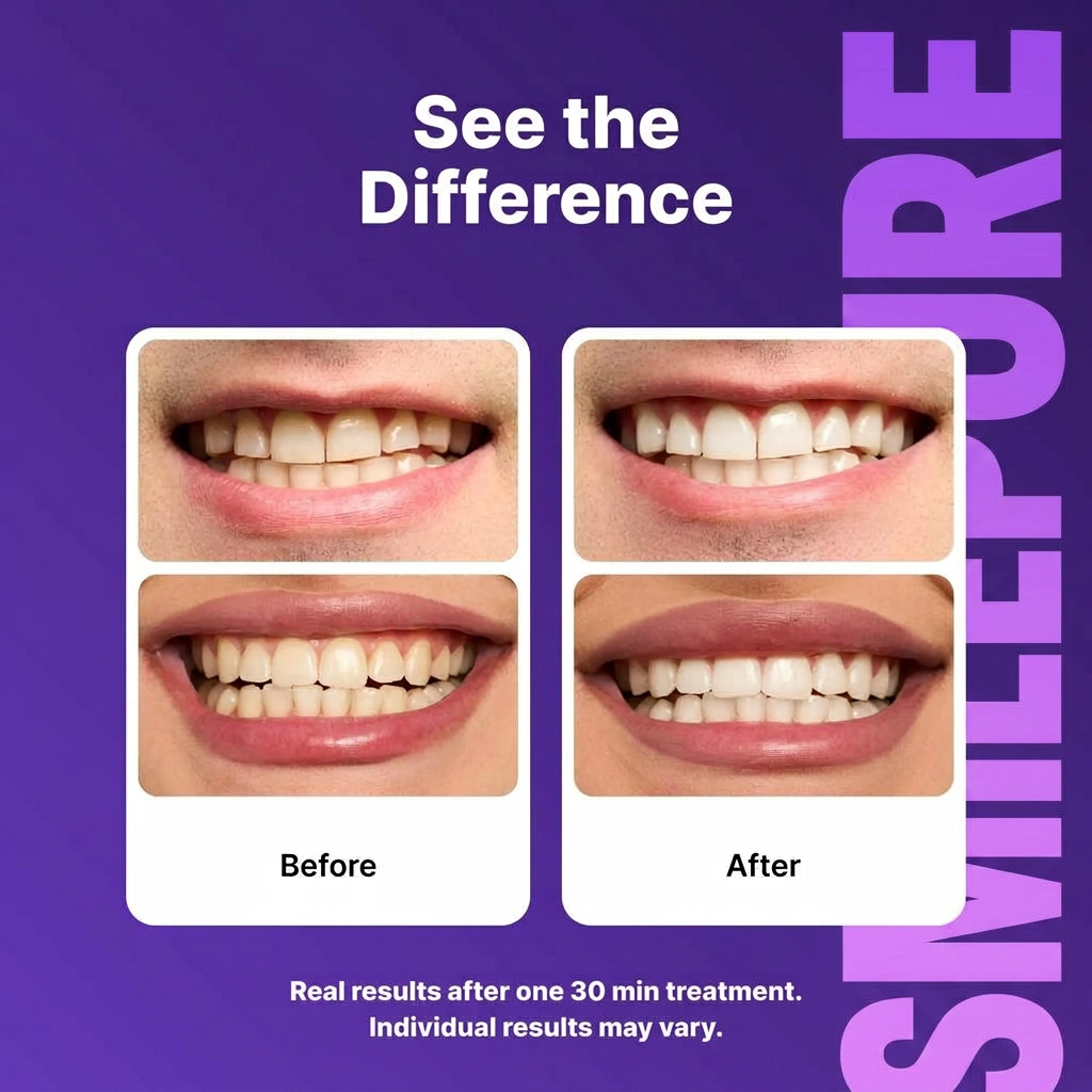 smilepure Purple Teeth Whitening Strips - 7/21 Sessions of Gentle, Peroxide-Free Whitening for Non-Sensitive Teeth
